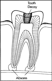 TOOTH