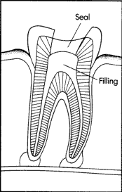 TOOTH
