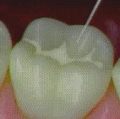 TOOTH